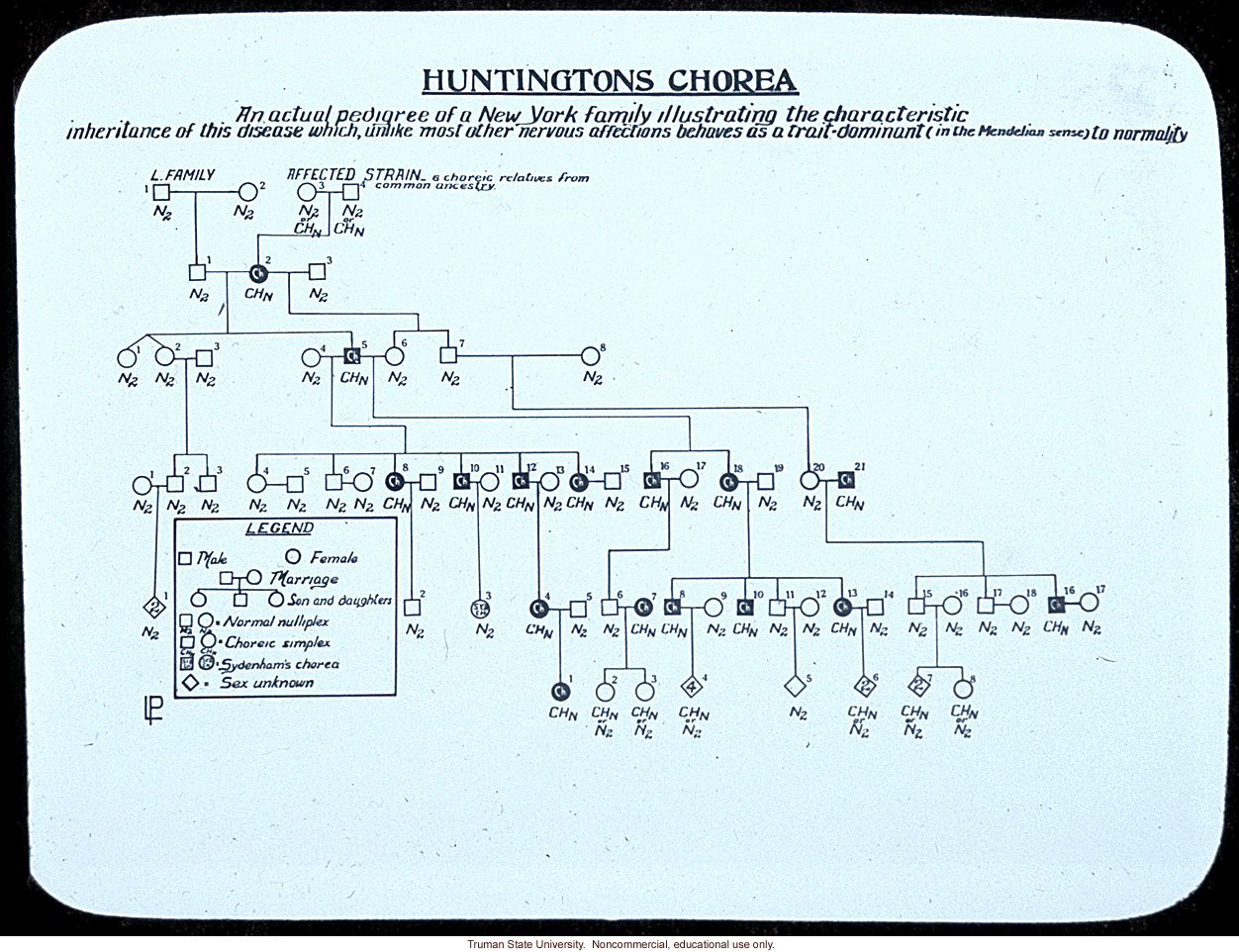 Huntington's chorea pedigree