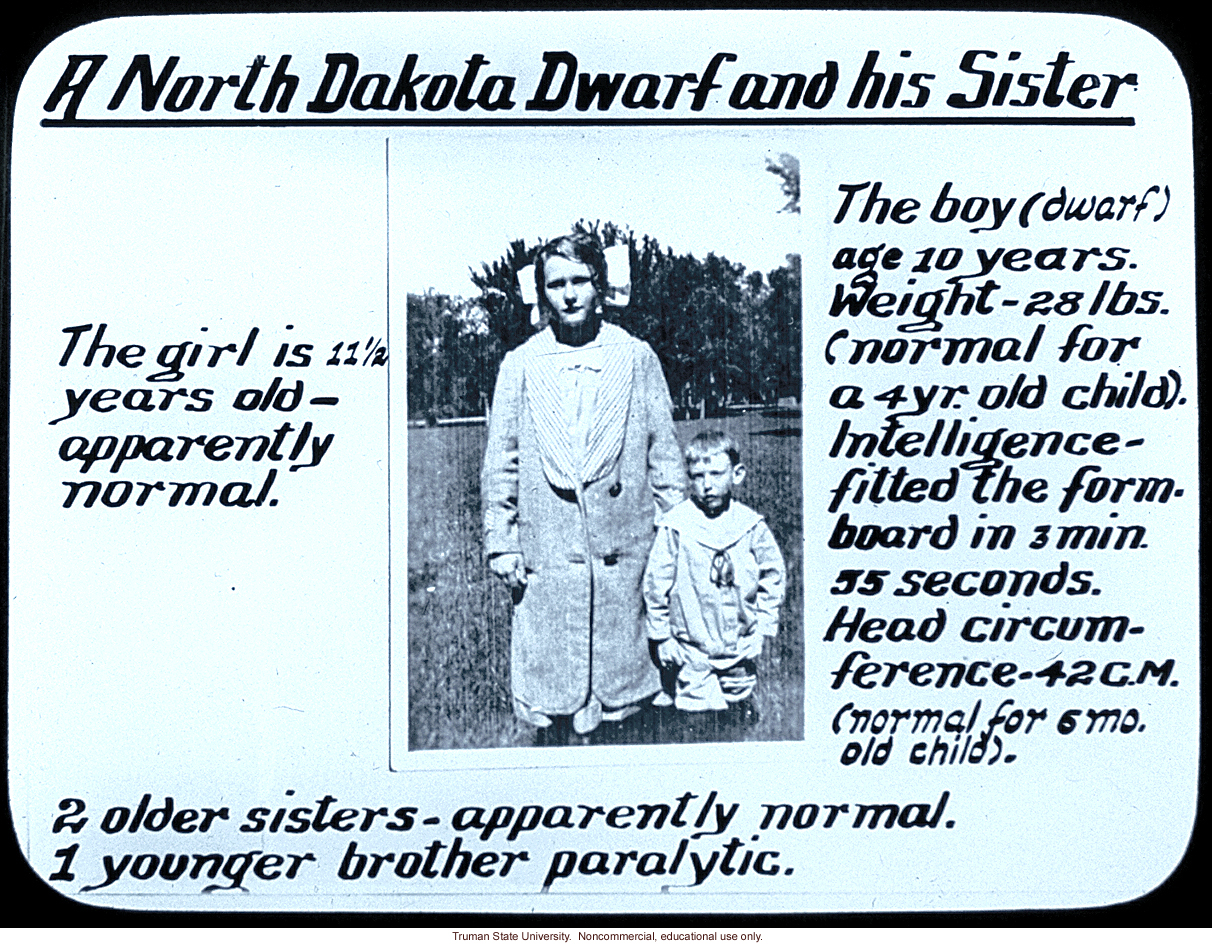&quote;A North Dakota dwarf and his sister&quote;