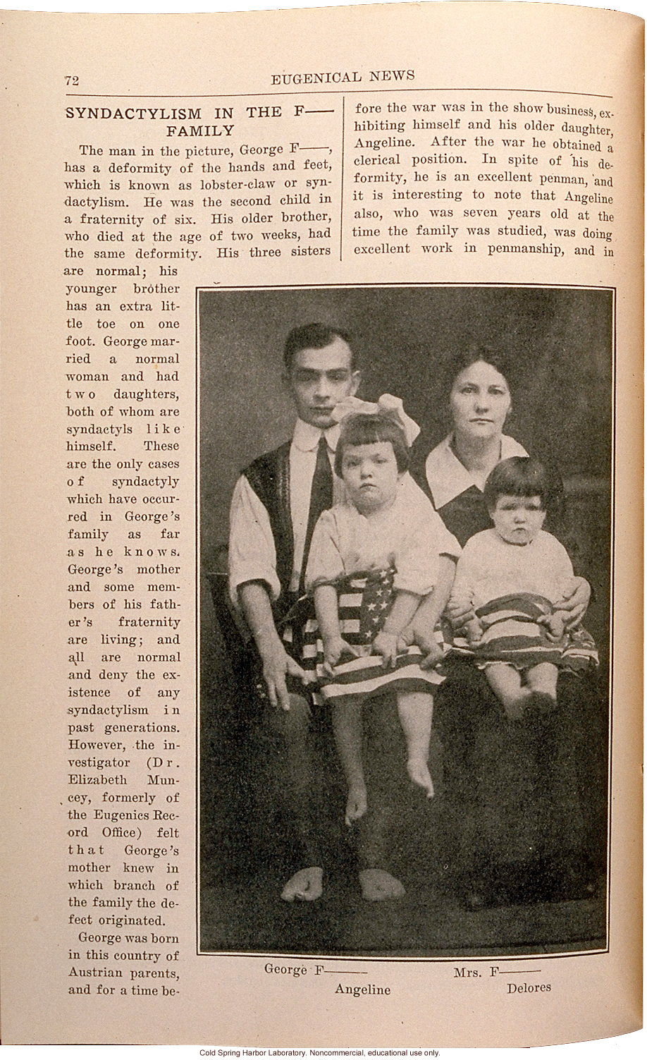 &quote;Syndactyly in the F__ Family,&quote; Eugenical News (vol. 15), fused fingers or toes -- later shown to be an autosomal dominant trait