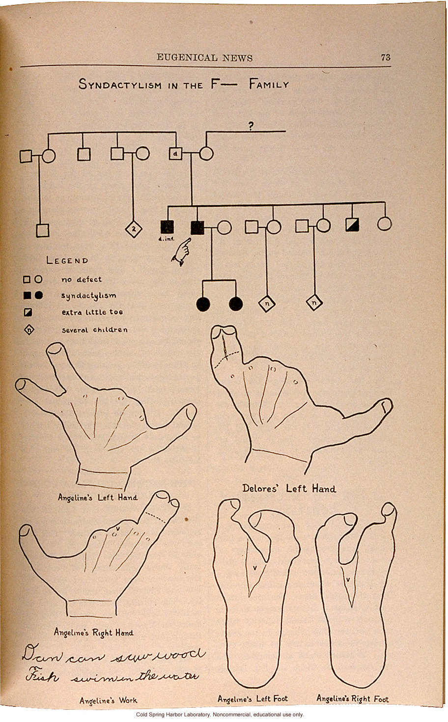 &quote;Syndactyly in the F__ Family,&quote; Eugenical News (vol. 15), fused fingers or toes -- later shown to be an autosomal dominant trait