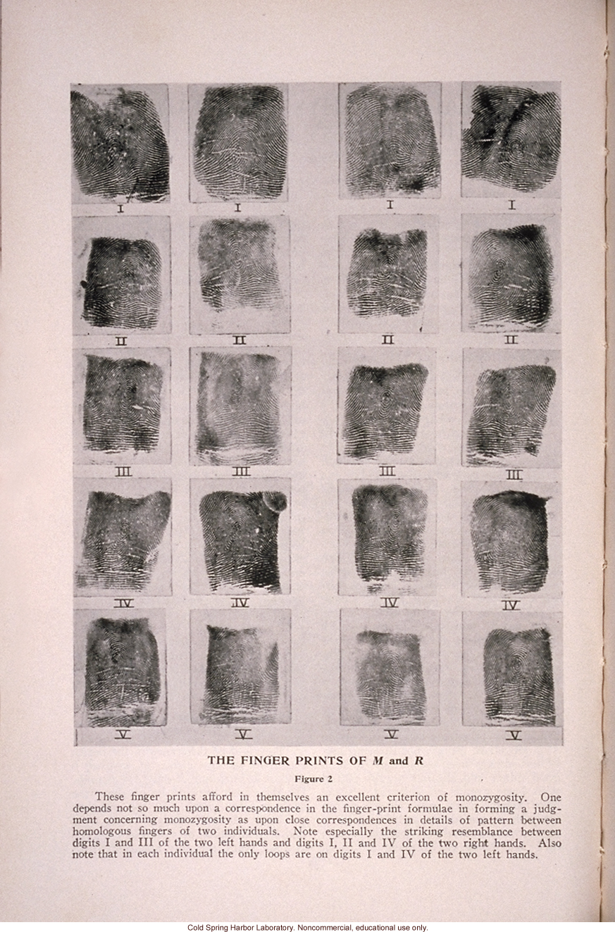 &quote;Mental and Physical Traits of Identical Twins Reared Apart,&quote; by H.H. Newman, <i>Journal of Heredity</i> (vol. 25)
