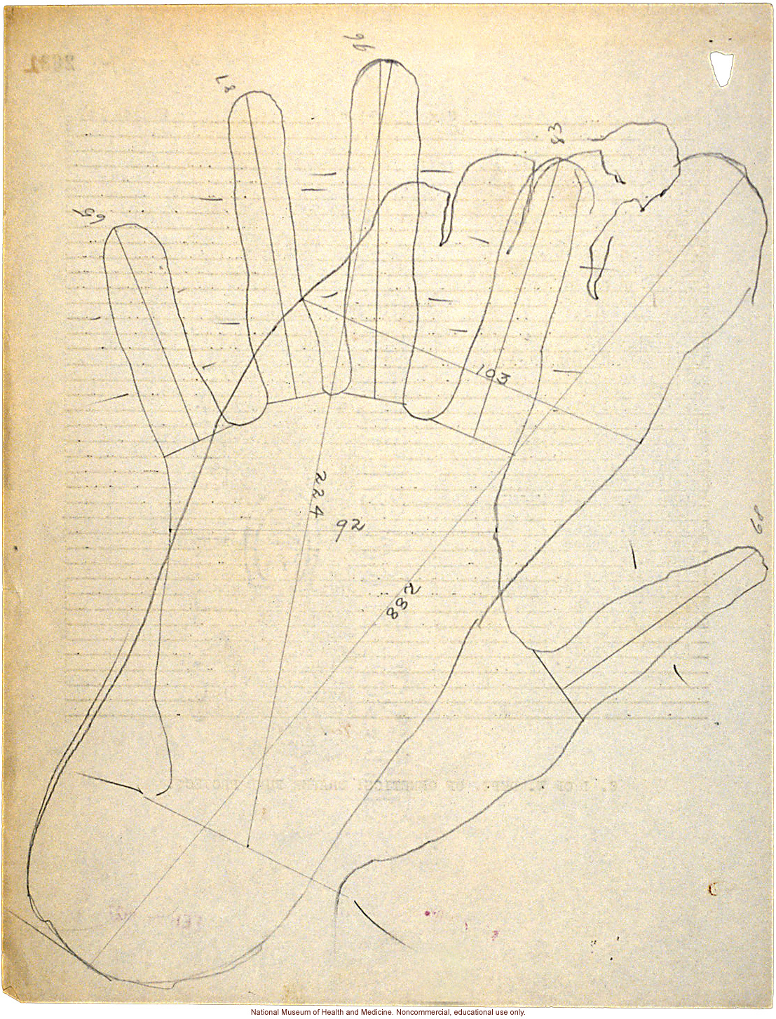 Mico College anthropometric case 2: photos, Schedule 3, measurements, pedigree, notes; by Morris Steggerda for <i>Race Crossing in Jamaica</i>