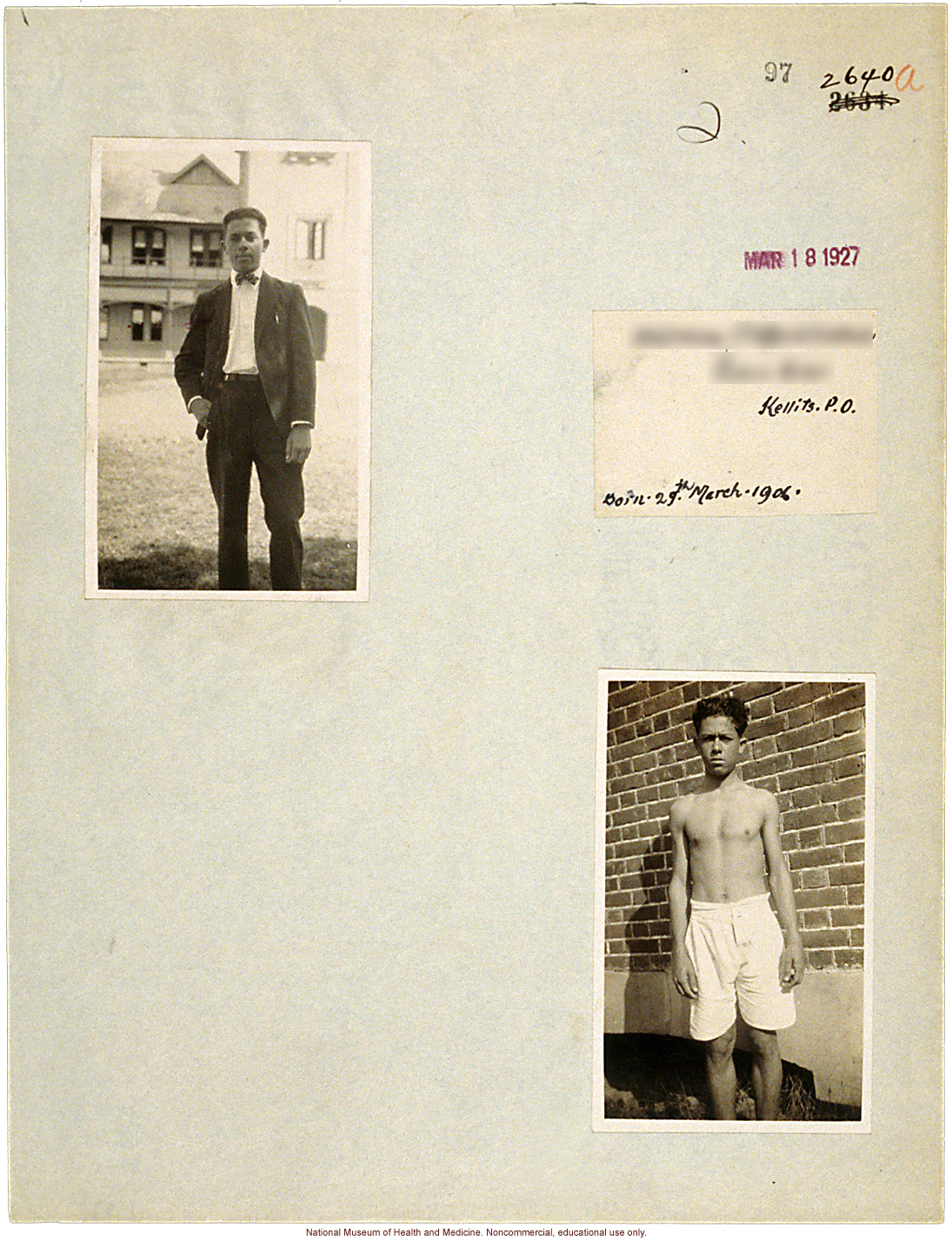 Mico College anthropometric case 3: photos, measurements, pedigree, notes; by Morris Steggerda for <i>Race Crossing in Jamaica</i>