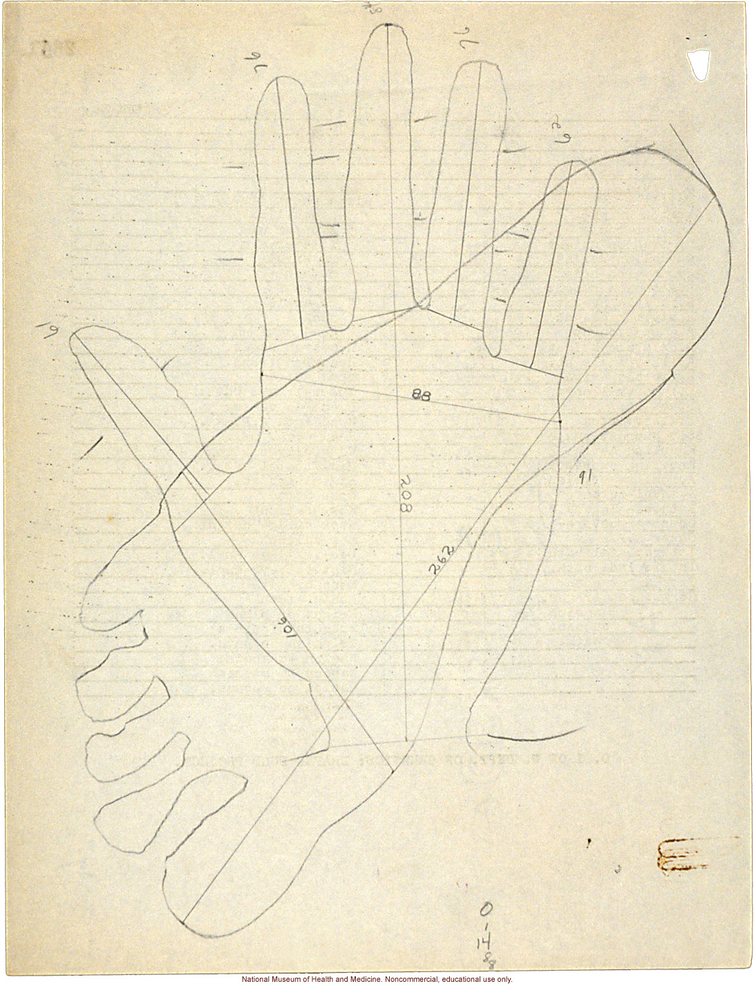 Mico College anthropometric case 3: photos, measurements, pedigree, notes; by Morris Steggerda for <i>Race Crossing in Jamaica</i>