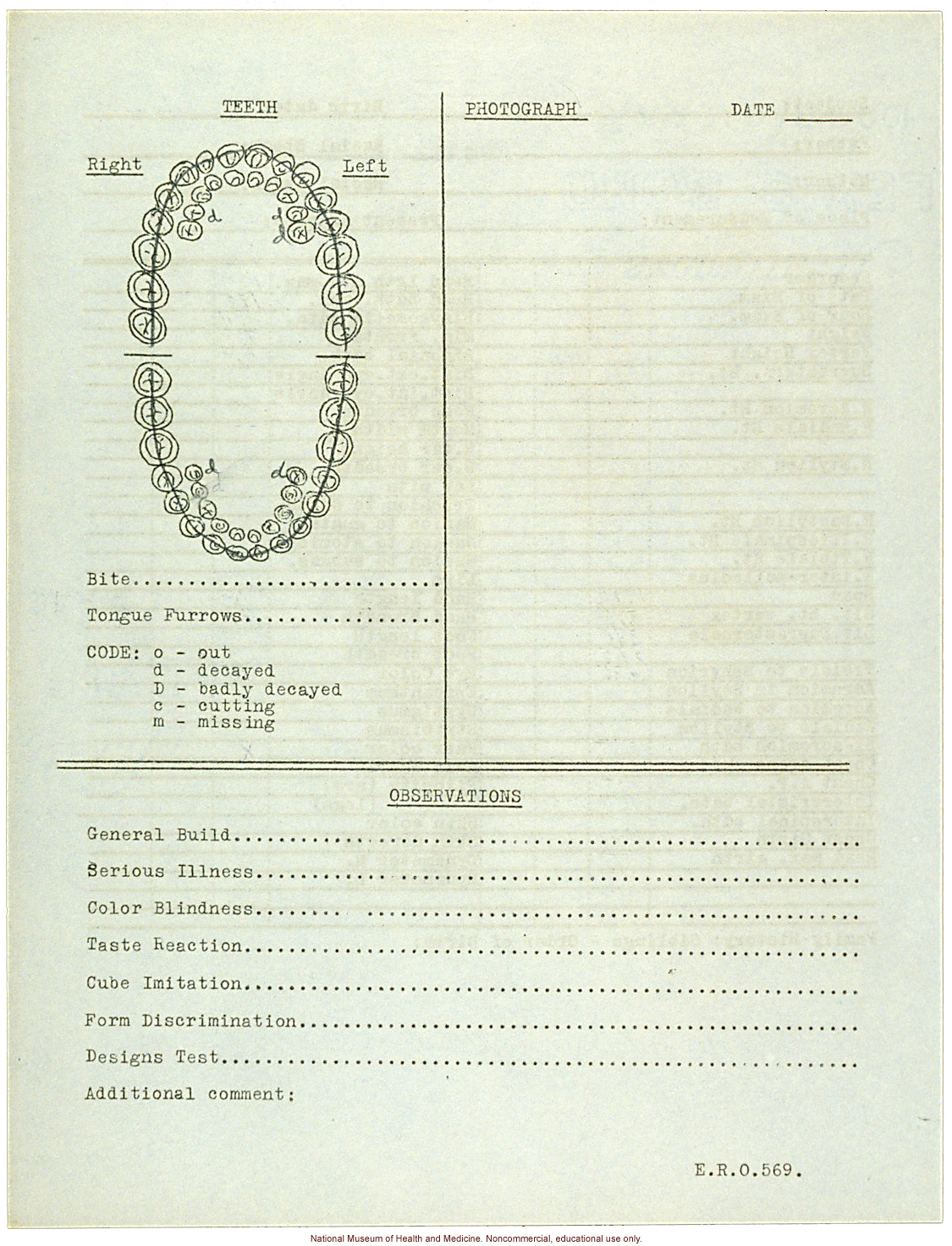 &quote;Growing Series&quote; of Navajo Female age 4-11, Fort Defiance, Arizona (anthropometry, dental charts, and photographs)