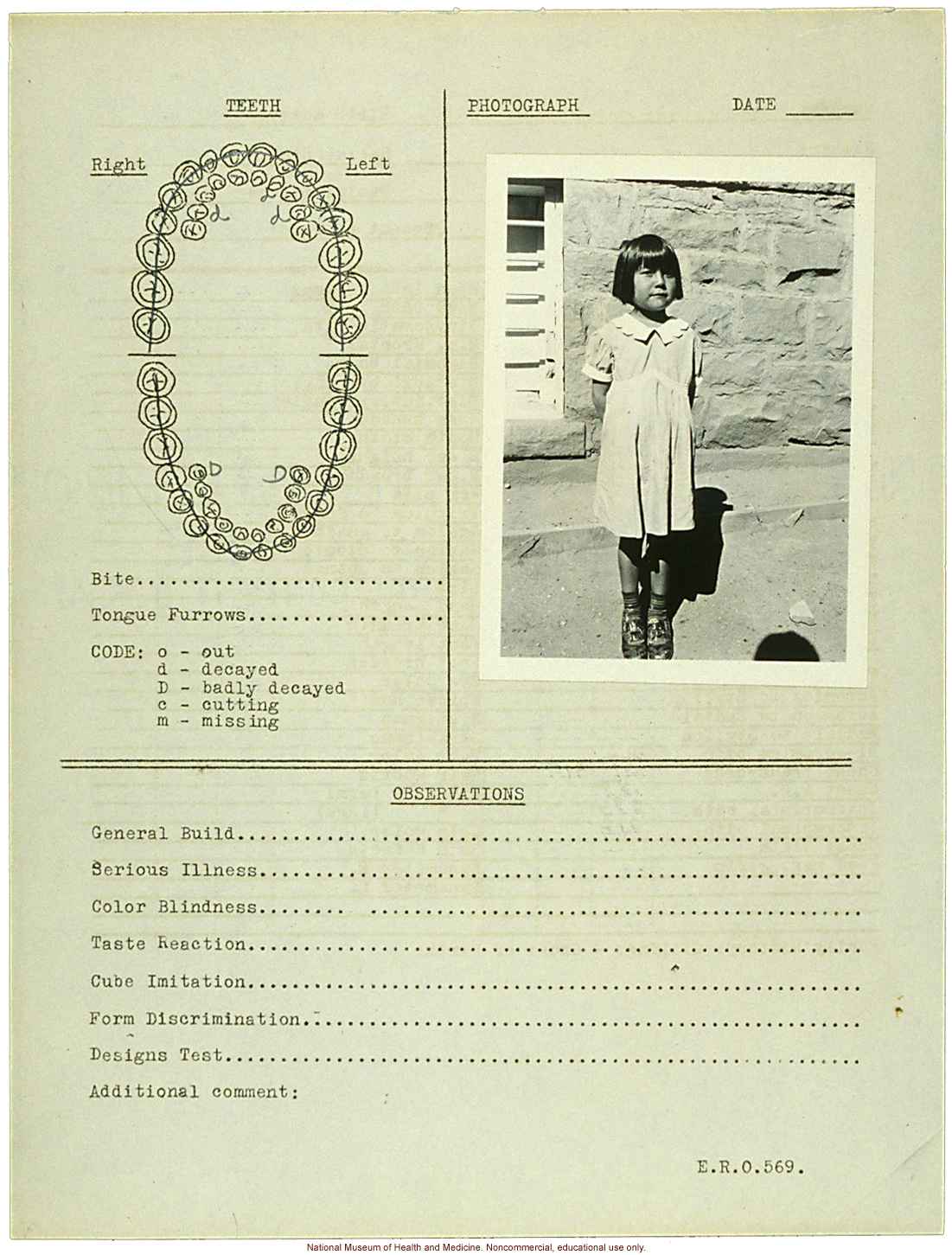 &quote;Growing Series&quote; of Navajo Female age 4-11, Fort Defiance, Arizona (anthropometry, dental charts, and photographs)