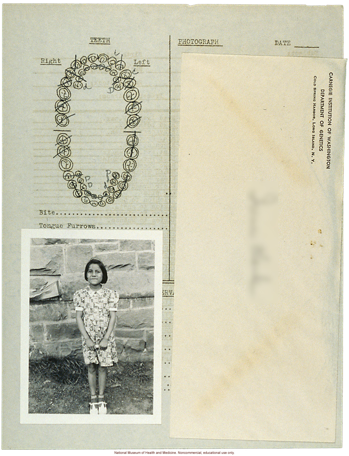 &quote;Growing Series&quote; of Navajo Female age 4-11, Fort Defiance, Arizona (anthropometry, dental charts, and photographs)