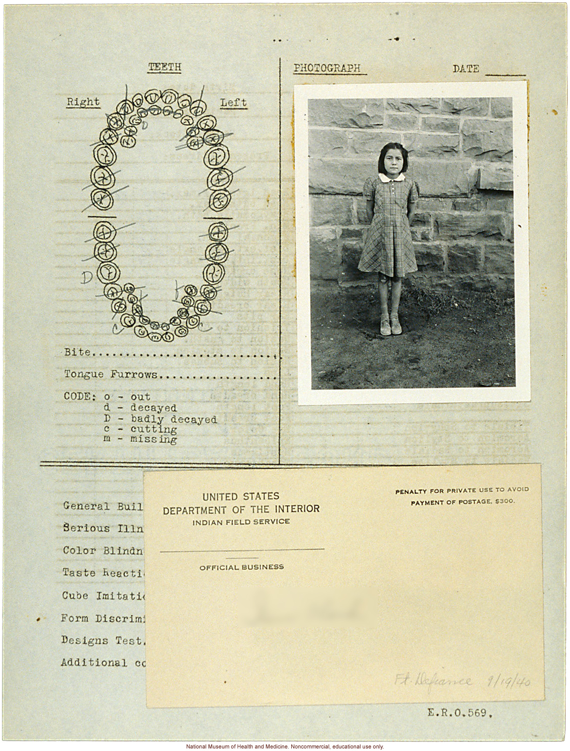 &quote;Growing Series&quote; of Navajo Female age 4-11, Fort Defiance, Arizona (anthropometry, dental charts, and photographs)