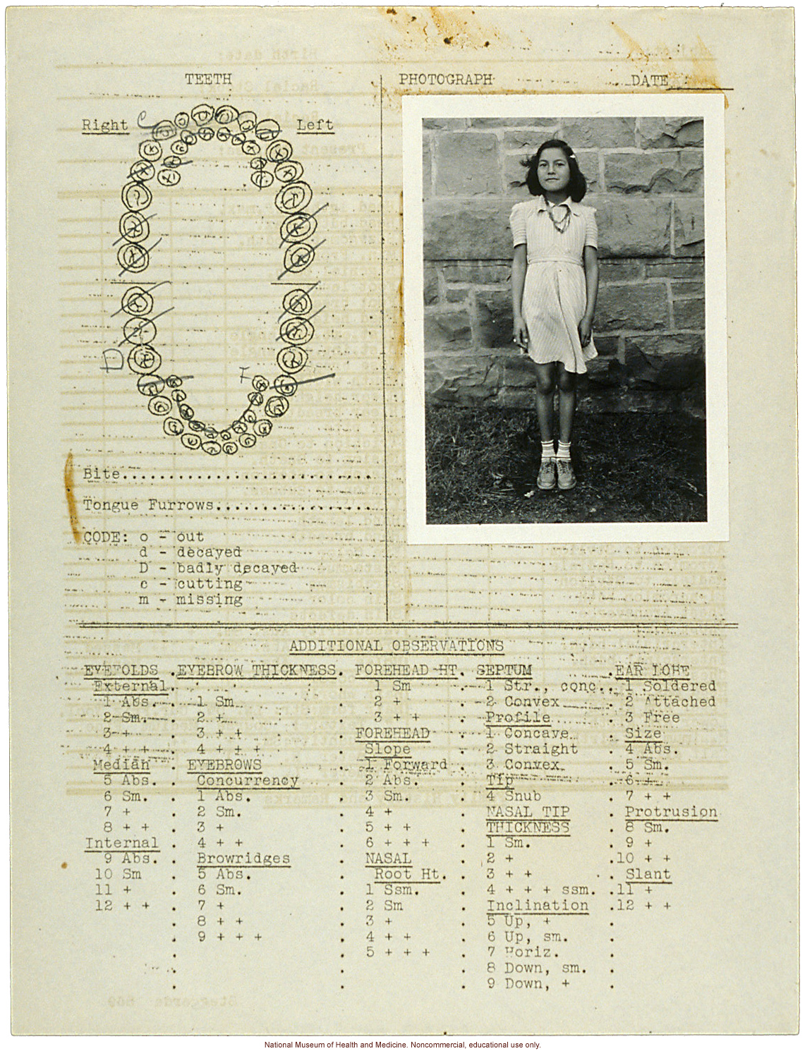 &quote;Growing Series&quote; of Navajo Female age 4-11, Fort Defiance, Arizona (anthropometry, dental charts, and photographs)