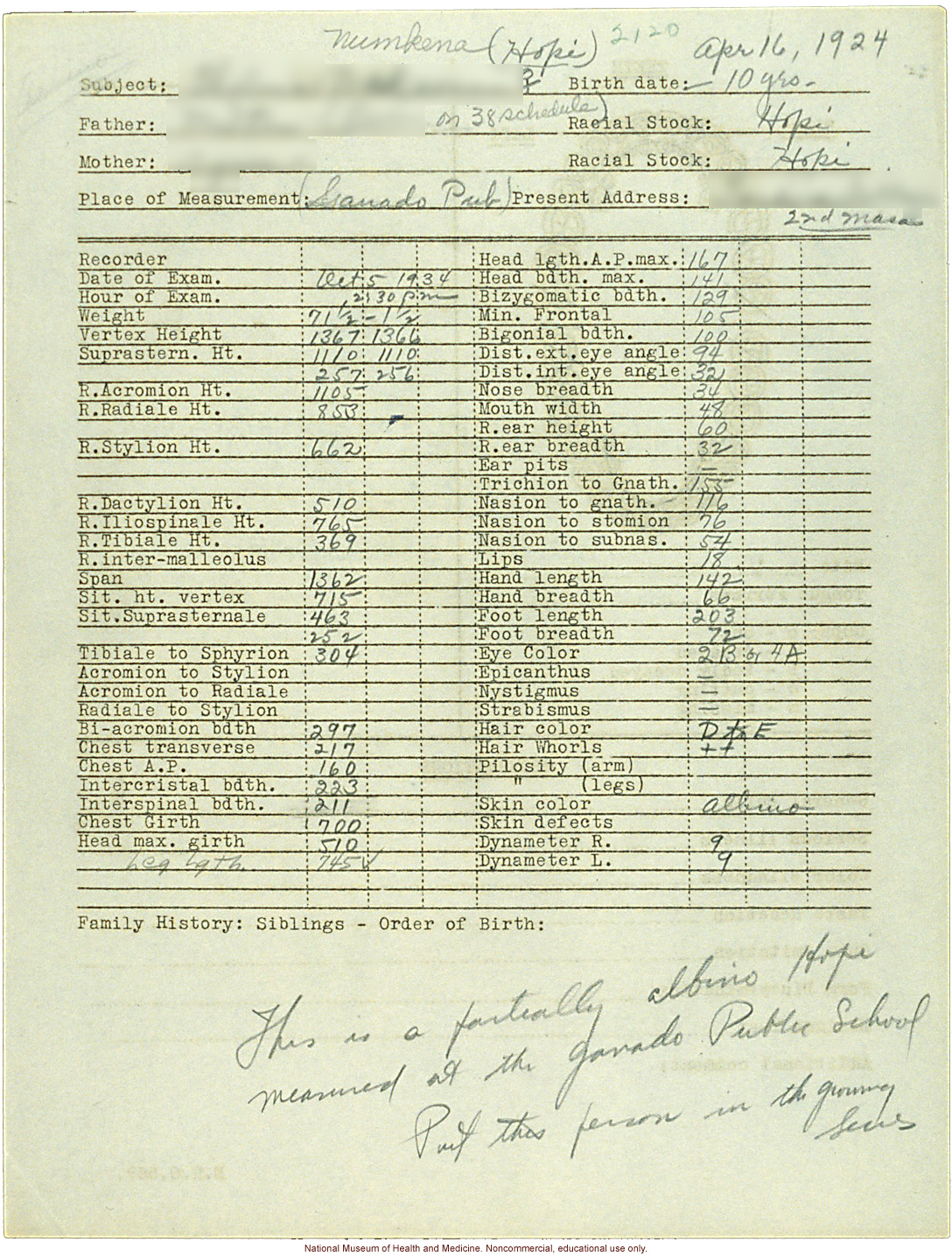 &quote;Growing Series&quote; of partial albino Hopi Female age 10-16, Ganado, Arizona (anthropometry, dental charts, and photographs)