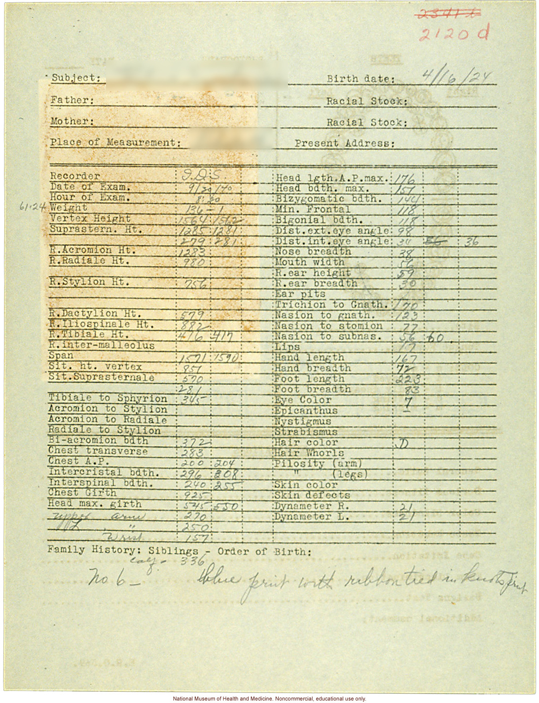 &quote;Growing Series&quote; of partial albino Hopi Female age 10-16, Ganado, Arizona (anthropometry, dental charts, and photographs)