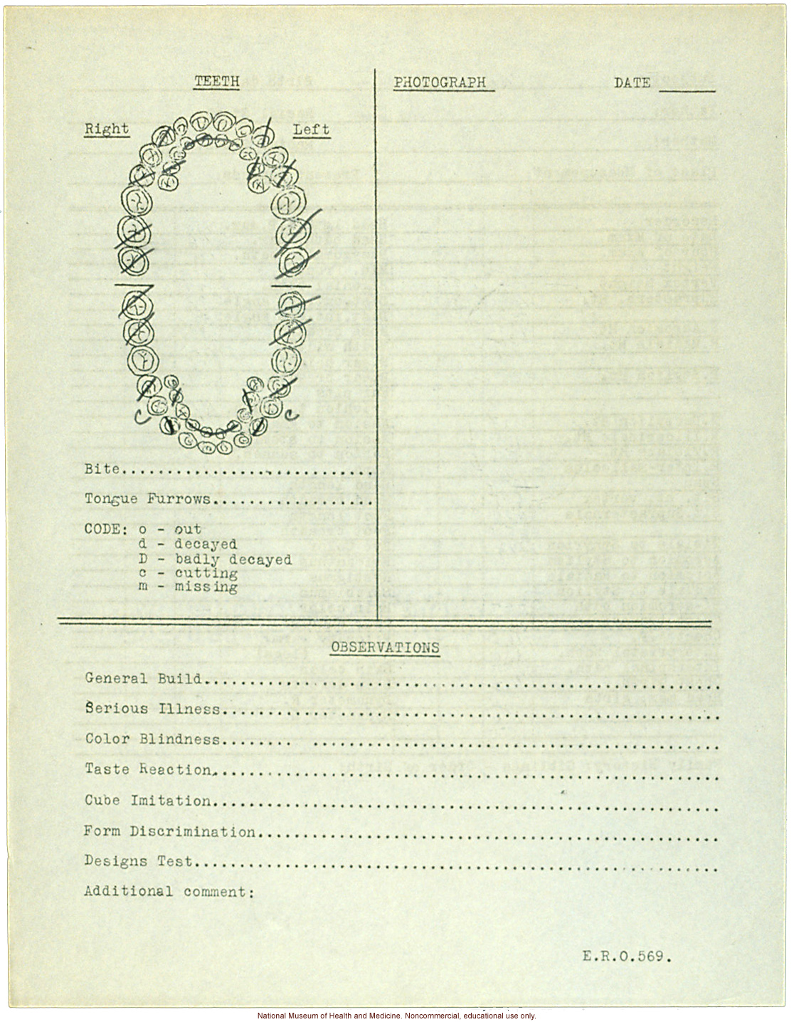 &quote;Growing Series&quote; of Navajo Male age 8-18, Tuba City and Ganado, Arizona (anthropometry, dental charts, and photographs)