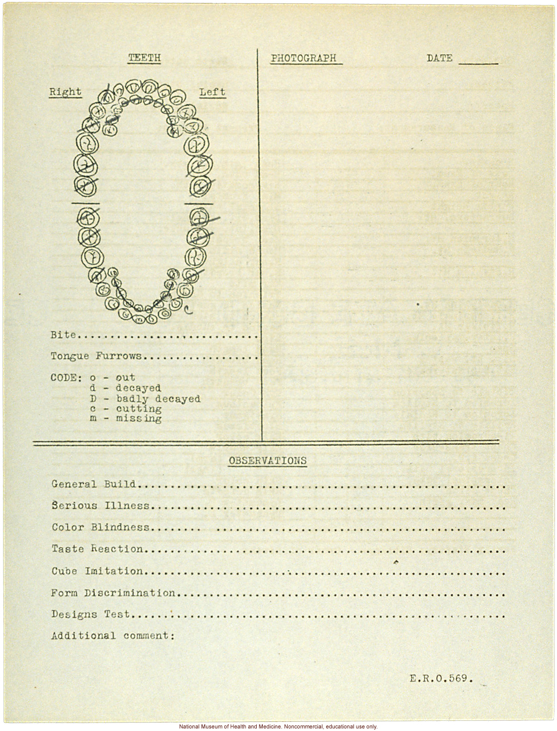 &quote;Growing Series&quote; of Navajo Male age 8-18, Tuba City and Ganado, Arizona (anthropometry, dental charts, and photographs)