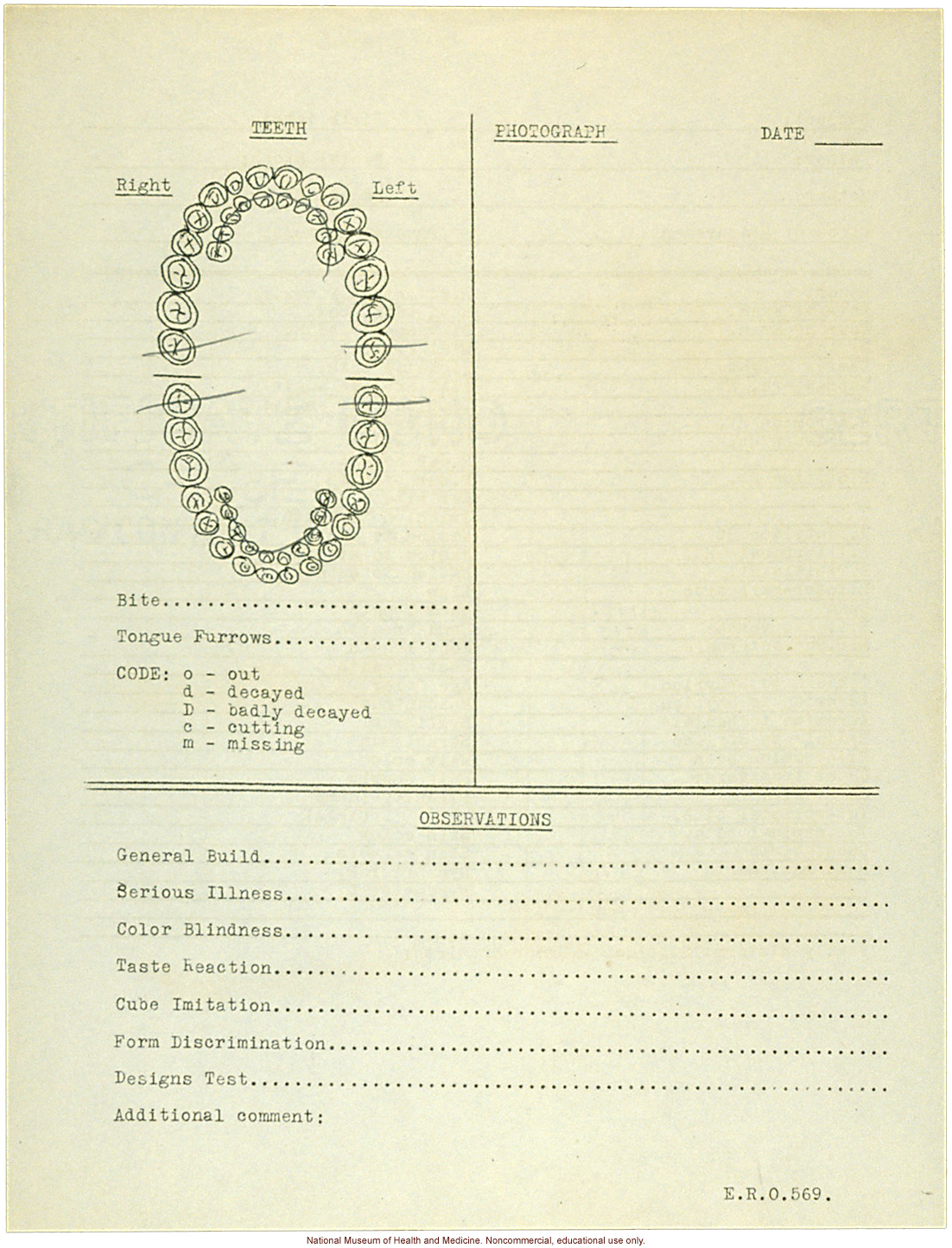 &quote;Growing Series&quote; of Navajo Male age 8-18, Tuba City and Ganado, Arizona (anthropometry, dental charts, and photographs)