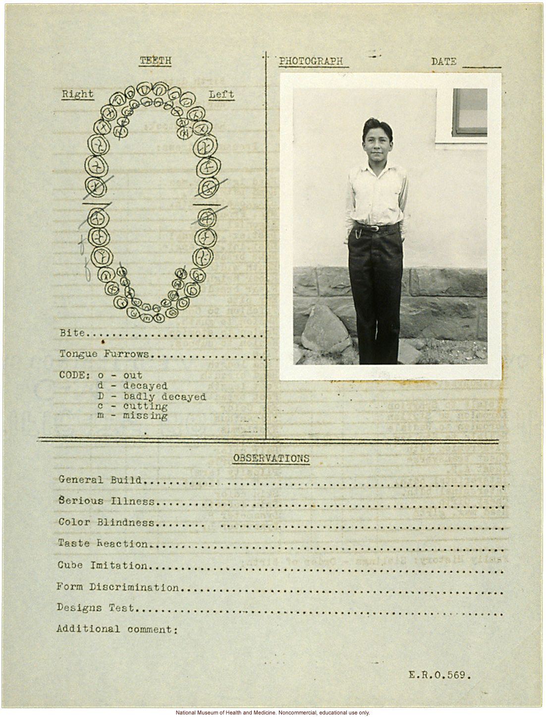 &quote;Growing Series&quote; of Navajo Male age 8-18, Tuba City and Ganado, Arizona (anthropometry, dental charts, and photographs)