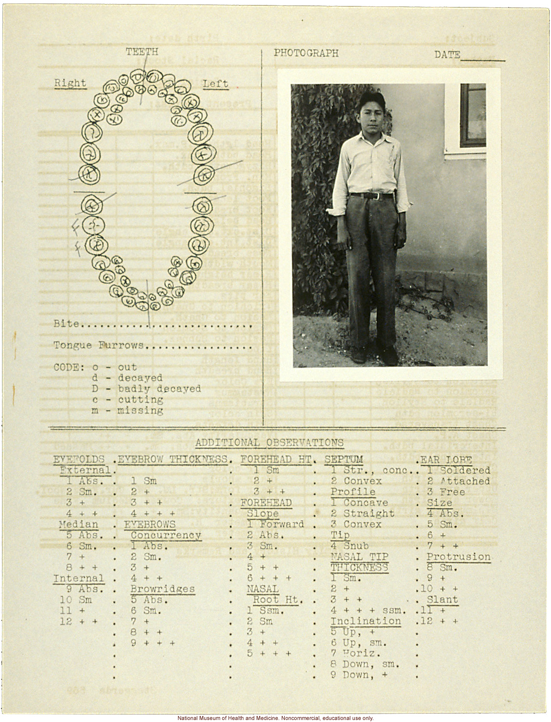&quote;Growing Series&quote; of Navajo Male age 8-18, Tuba City and Ganado, Arizona (anthropometry, dental charts, and photographs)