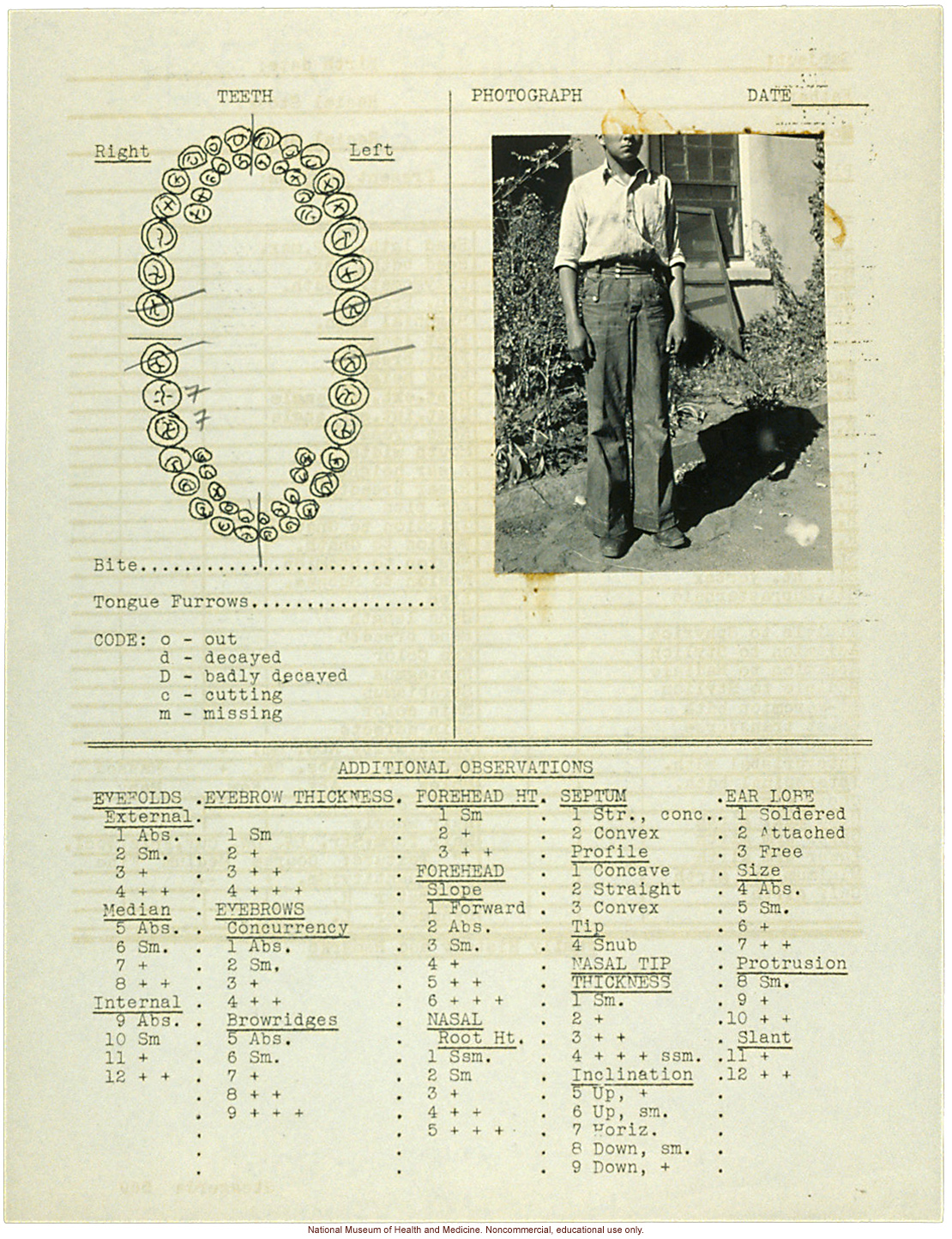 &quote;Growing Series&quote; of Navajo Male age 8-18, Tuba City and Ganado, Arizona (anthropometry, dental charts, and photographs)