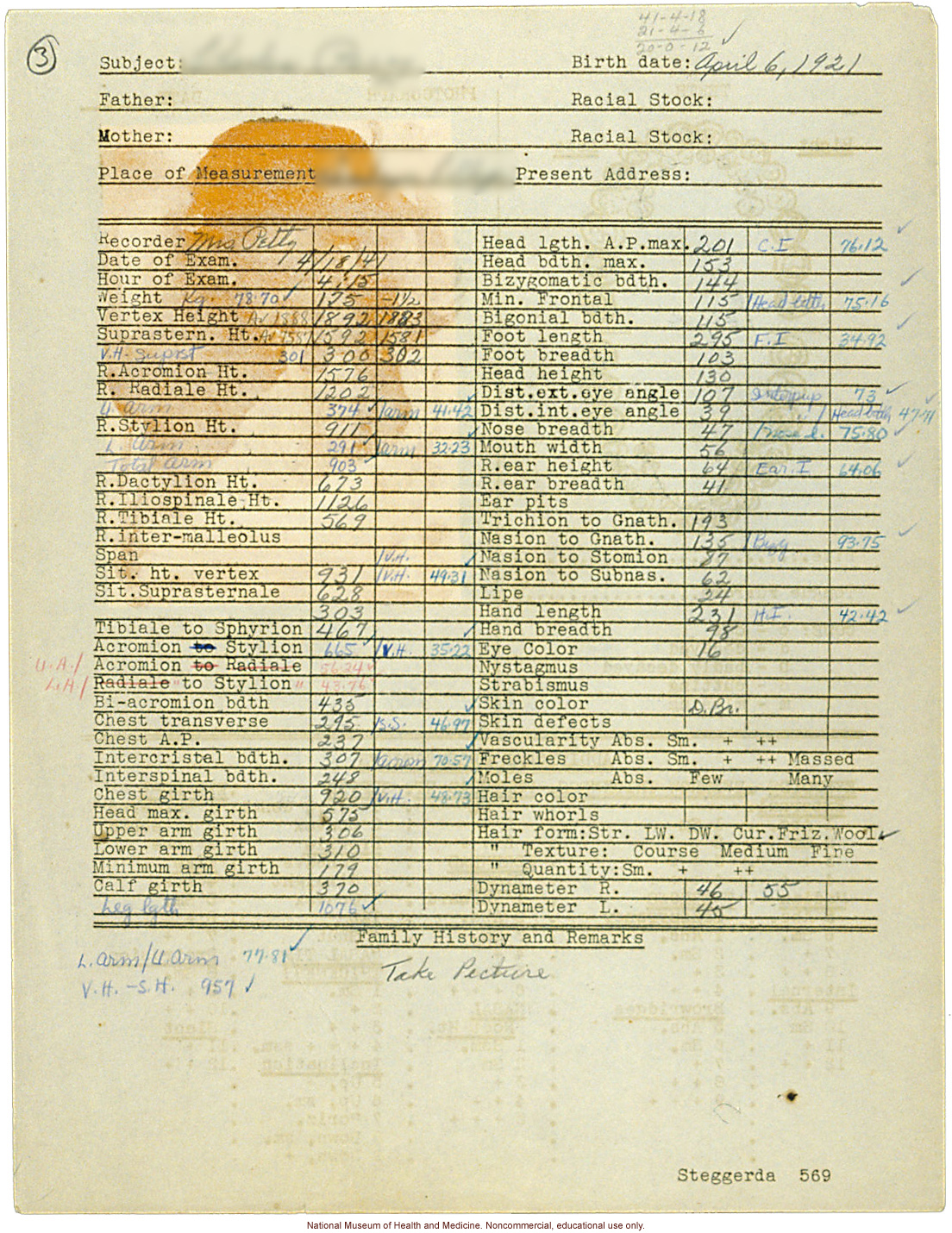 Male anthropometric case, from &quote;100 College Boys,&quote; Tuskegee Institute, Alabama (measurements, dental chart, and photograph)