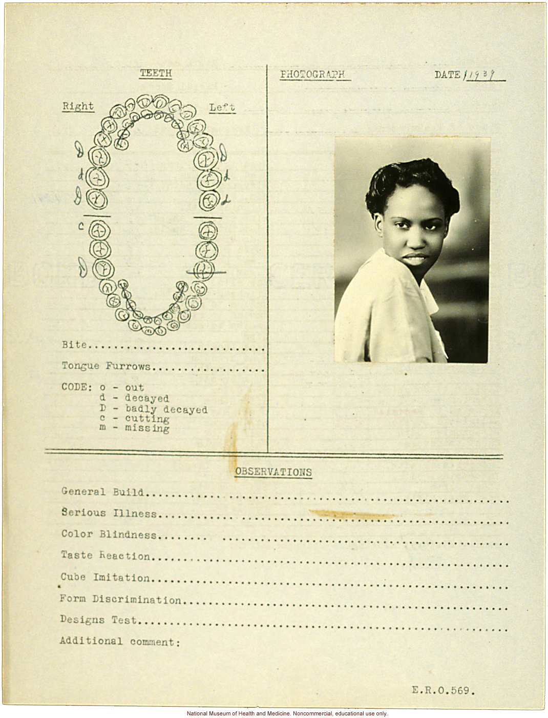 Female anthropometric case, from &quote;100 College Girls,&quote; Tuskegee Institute, Alabama (measurements, dental chart, and photograph)