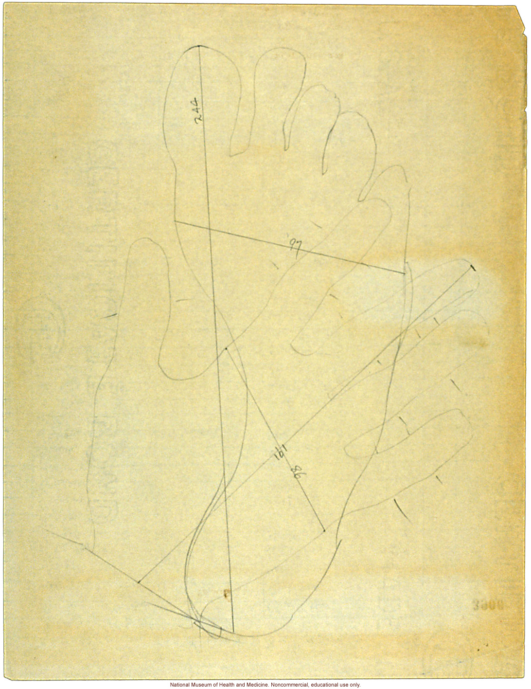 Seaford Town male anthropometric case: photo, measurements, finger prints, Schedule 3, notes; by Morris Steggerda for <i>Race Crossing in Jamaica</i>