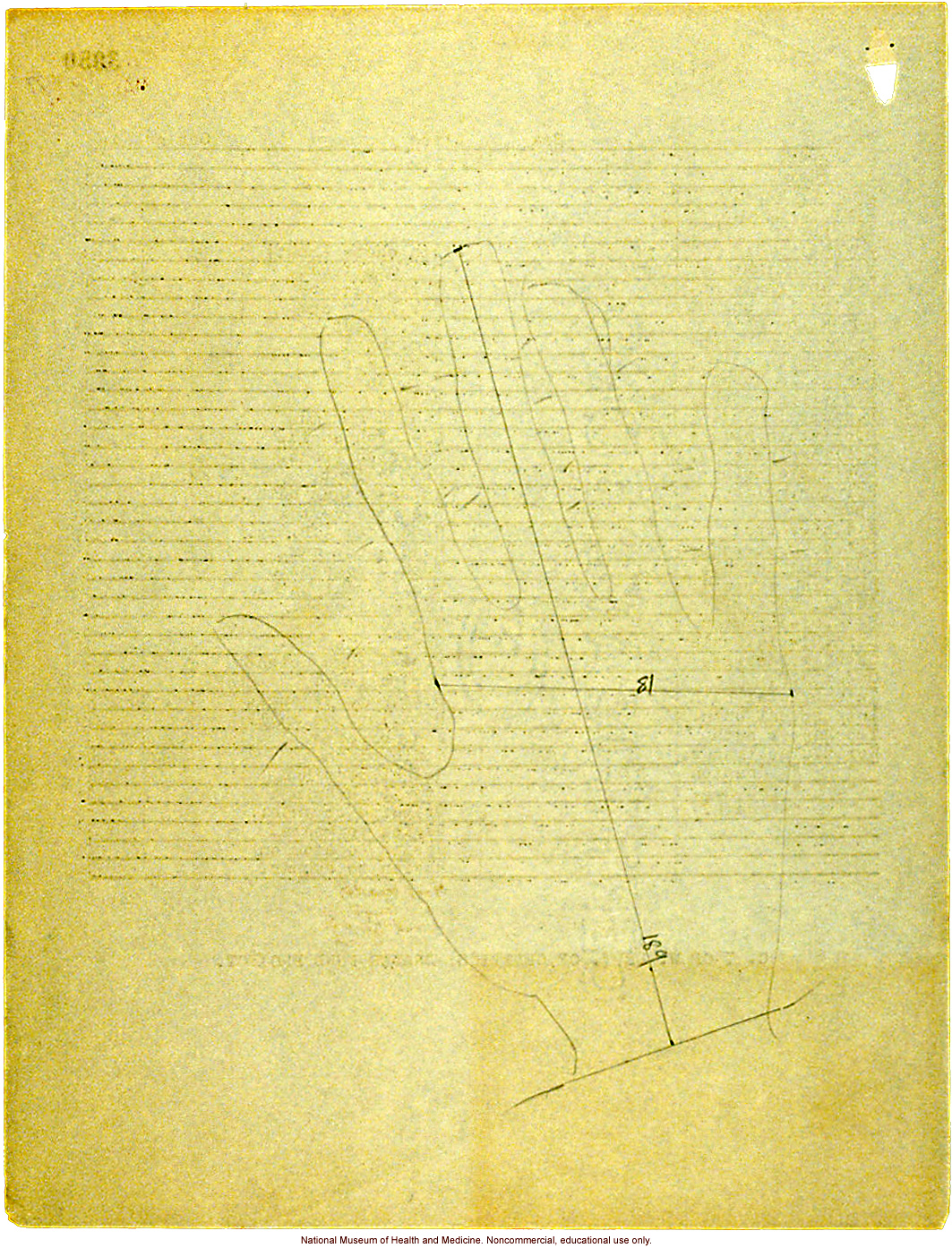 Seaford Town female anthropometric case: photos, measurements, finger prints, Schedule 3; by Morris Steggerda for <i>Race Crossing in Jamaica</i>