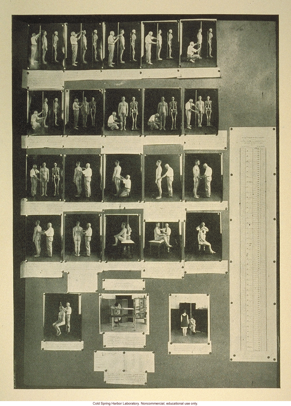 Poster on anthropometric methods