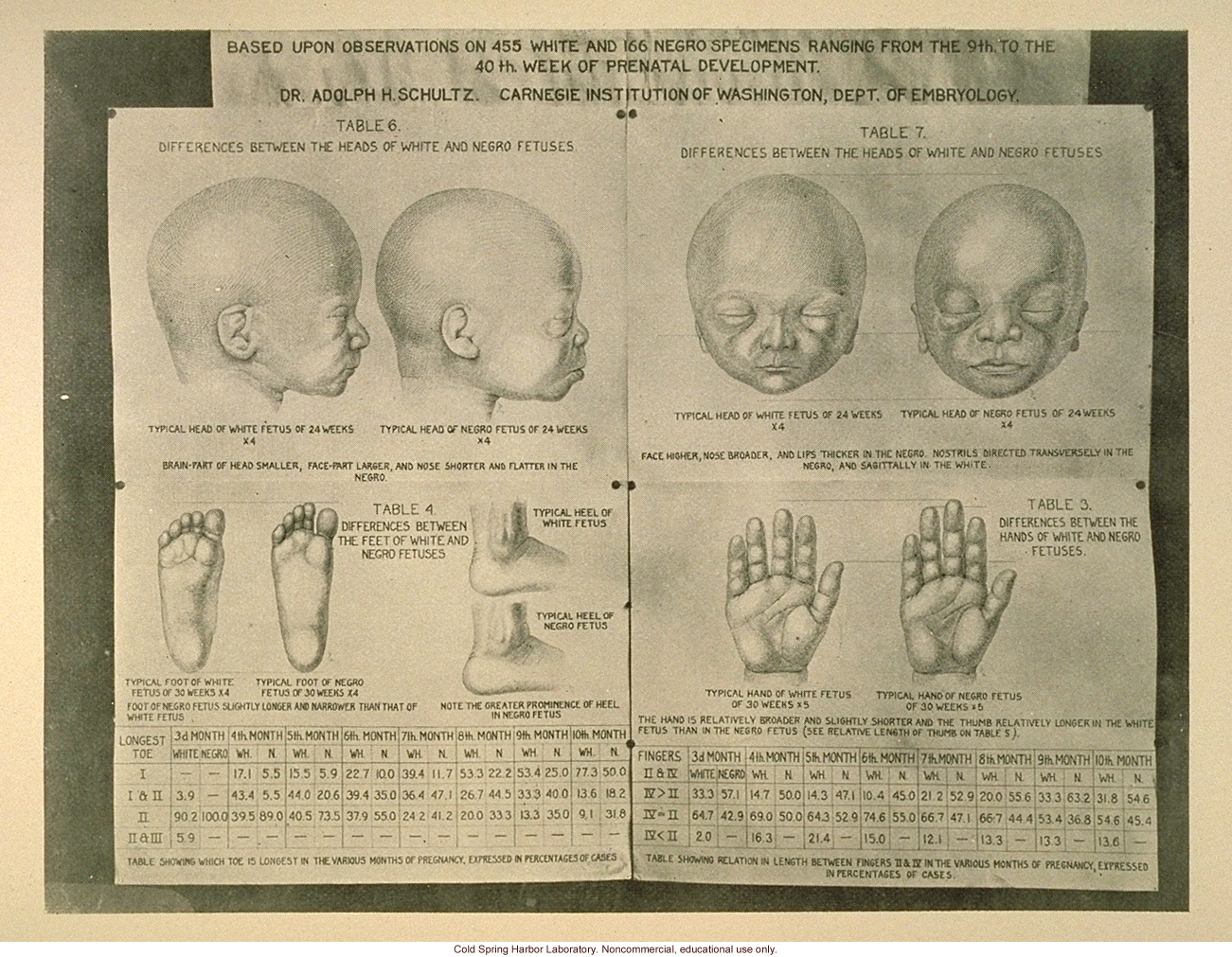 Difference between white and negro fetuses