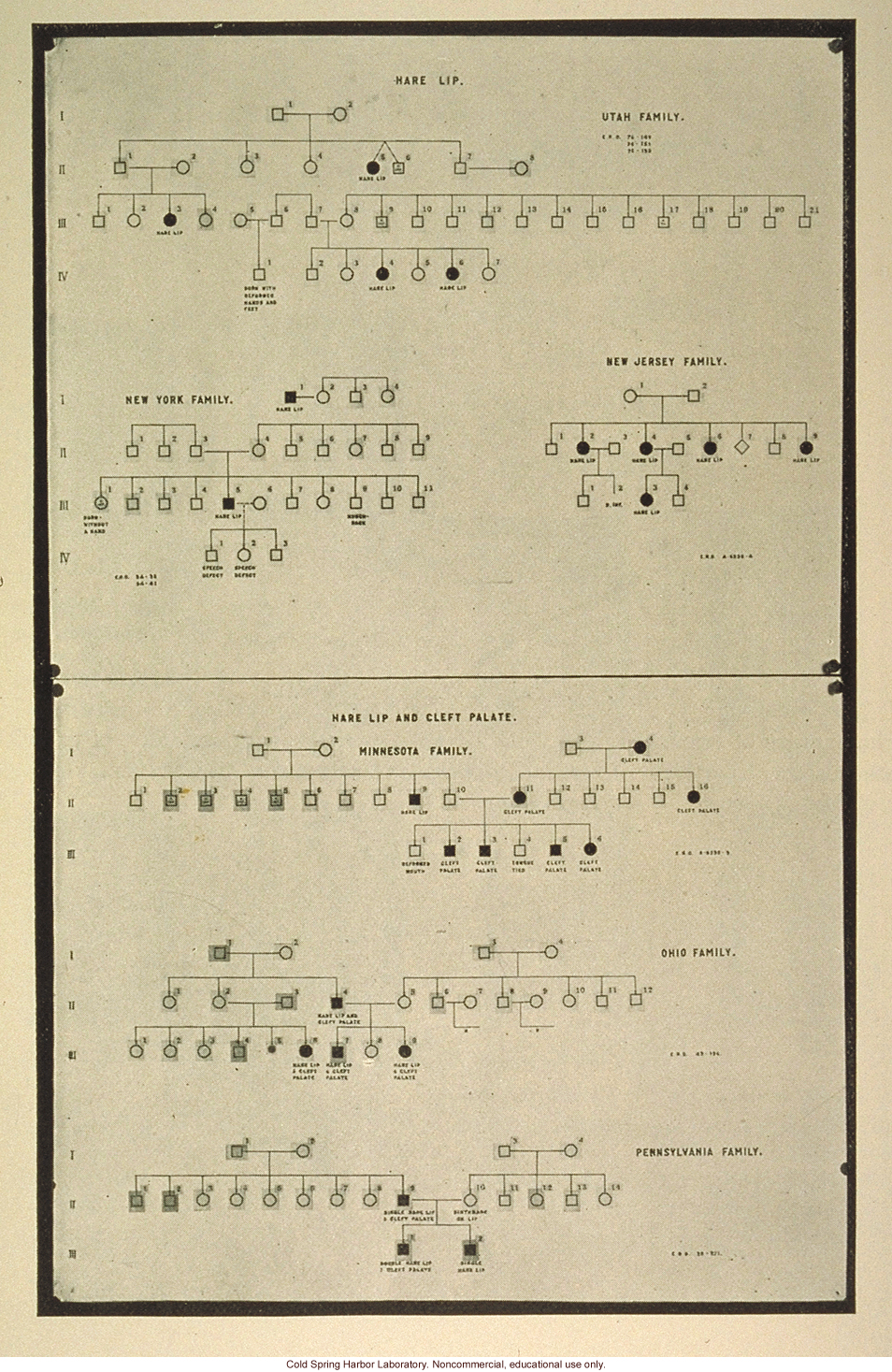 Heredity of harelip and cleft palate