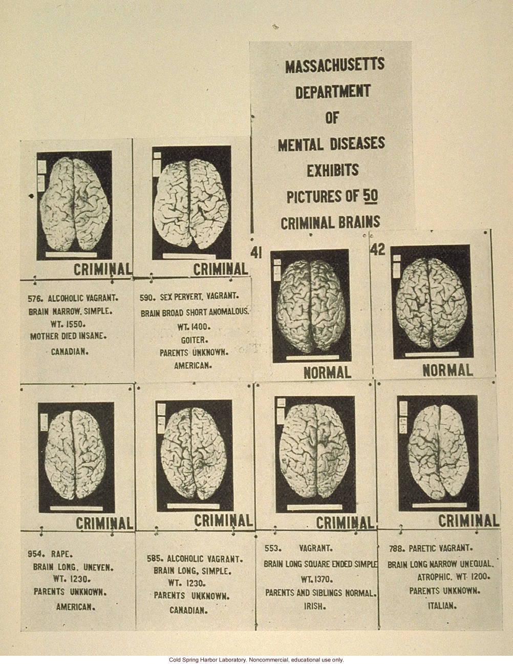 &quote;Massachusetts department of mental diseases exhibits pictures of 59 criminal brains&quote;