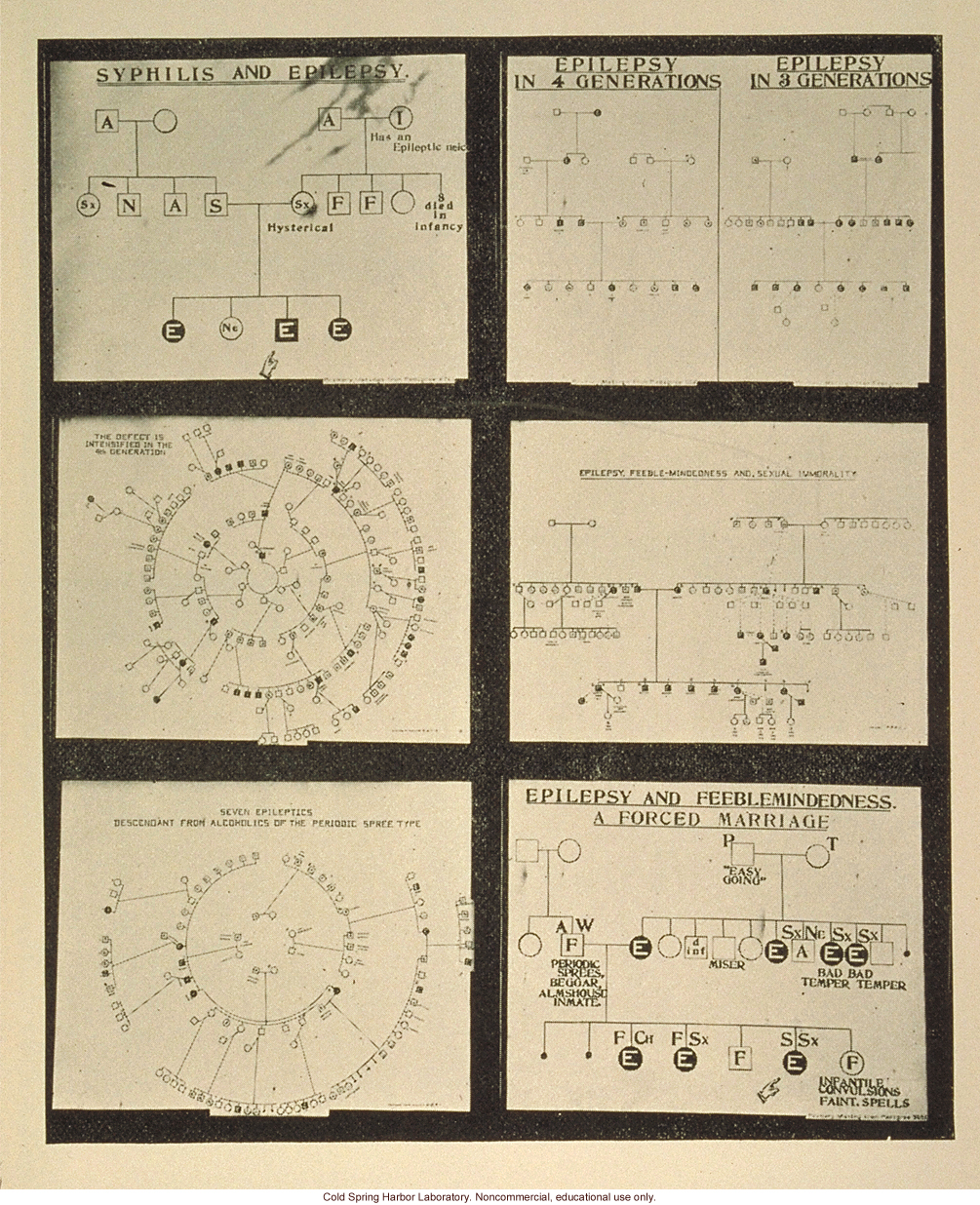 &quote;Heredity in epilepsy,&quote; Fig. 31