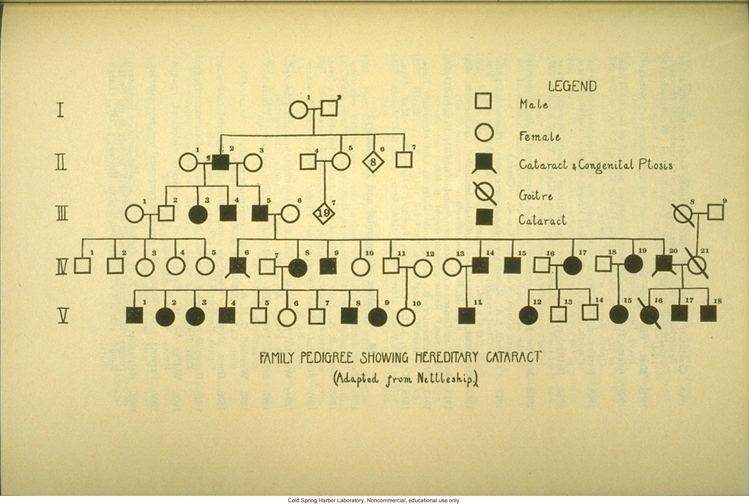 &quote;Family pedigree showing hereditary cataract&quote;