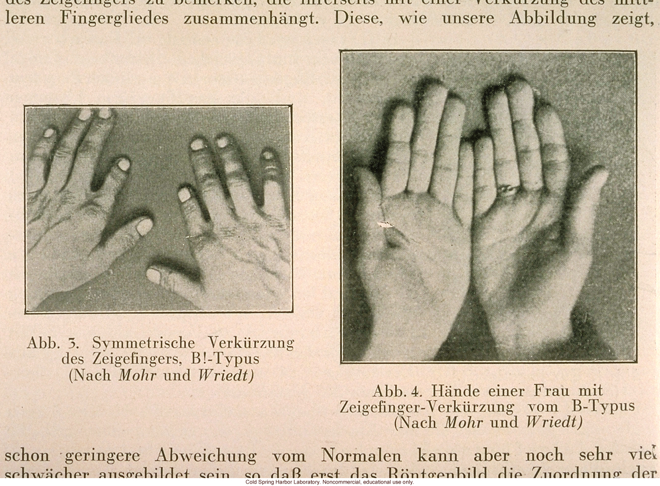 Eugenik: Erblehre, erbpflege (Eugenics: Hereditary teaching, preservation), October 1930