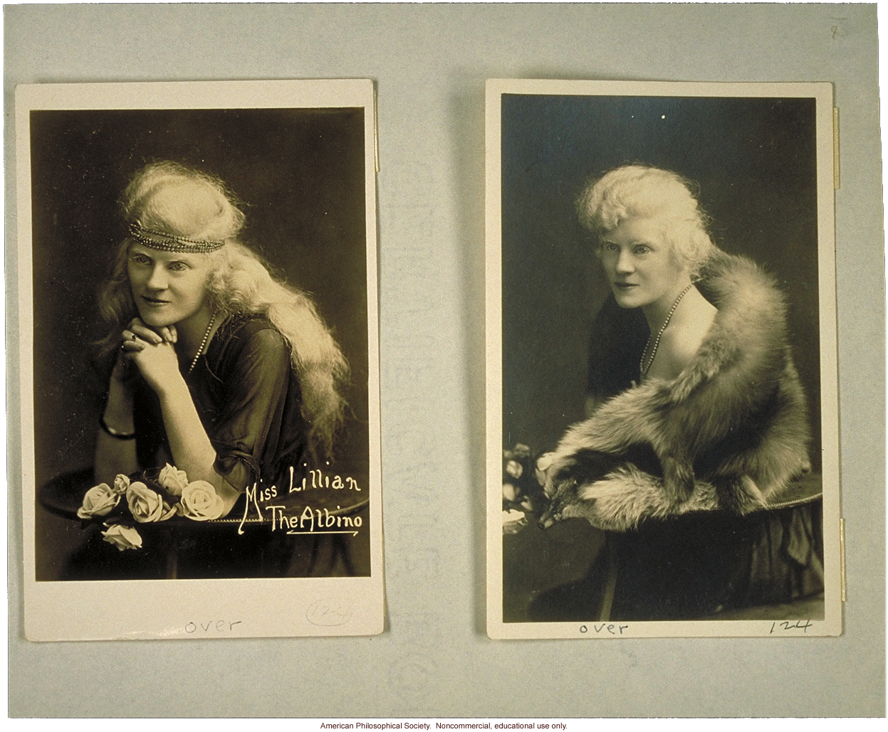 &quote;Miss Lillian the albino&quote;