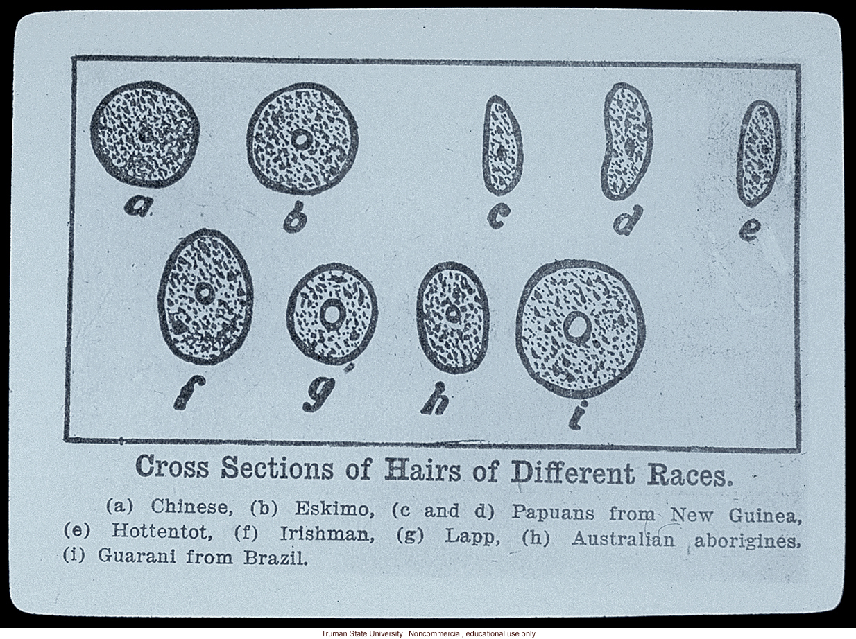 &quote;Cross sections of hairs of different races&quote;