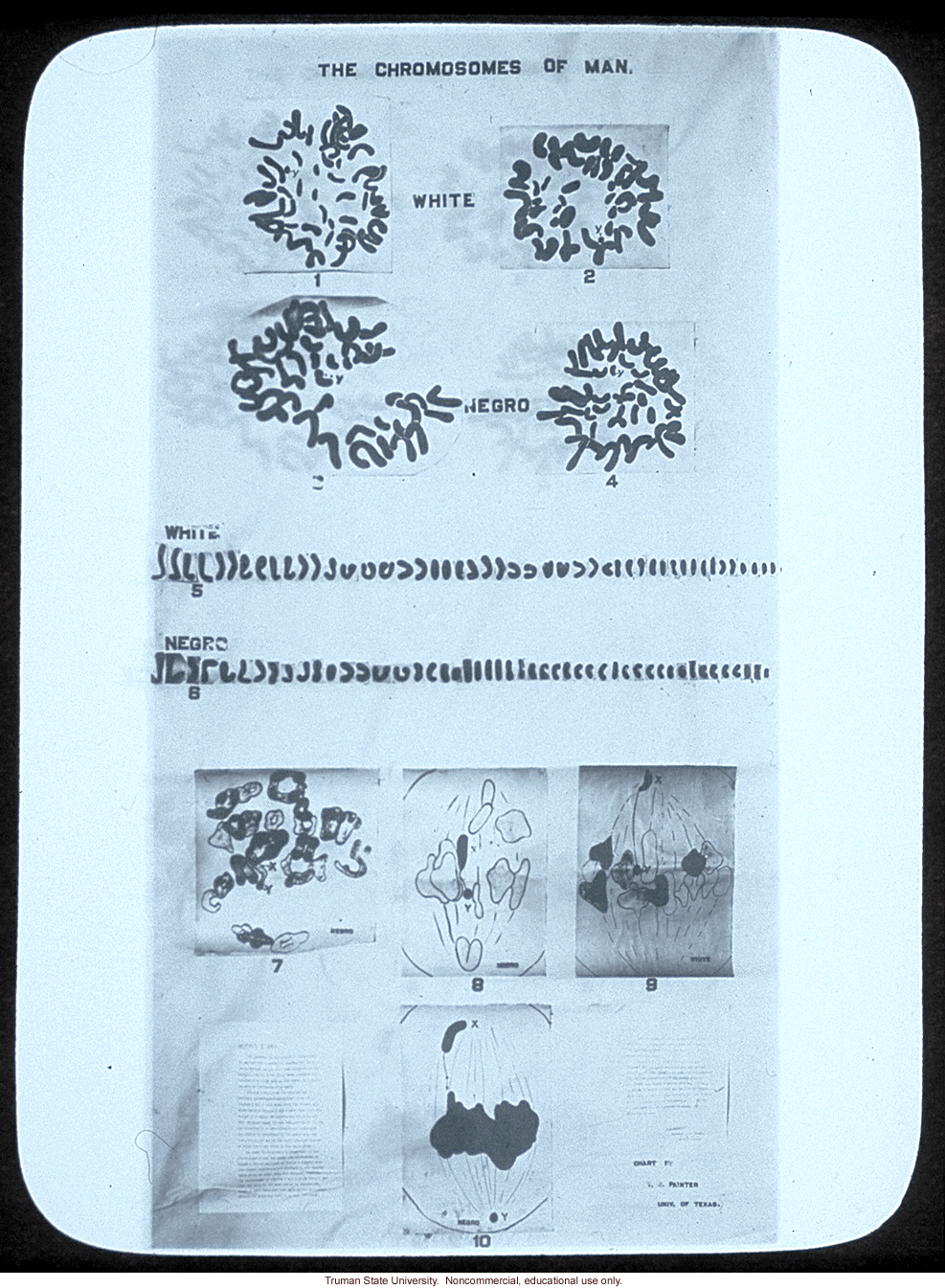 &quote;The chromosomes of man,&quote;  by T.S. Painter