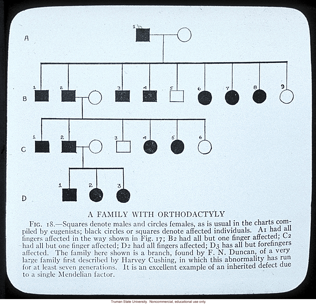 Pedigree: &quote;A family with orthodactyly&quote;