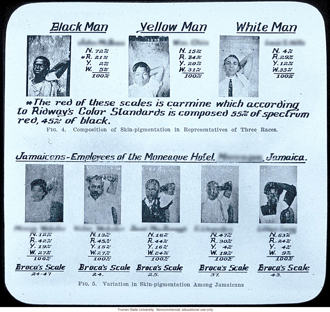 &quote;Variation in skin-pigmentations among Jamaicans&quote;