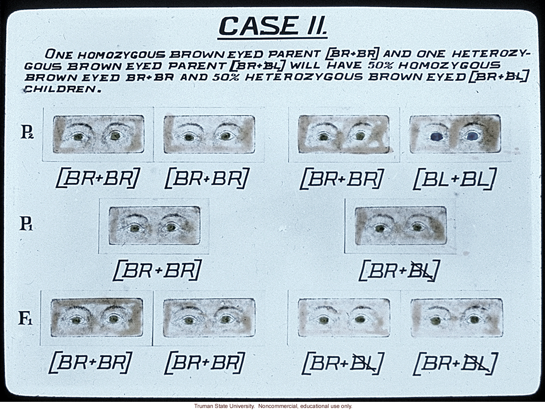 &quote;Case II: homozygous brown eyed parent and heterozygous brown eyed parent will have...&quote;