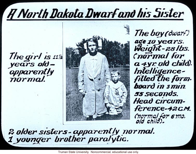 &quote;A North Dakota dwarf and his sister&quote;