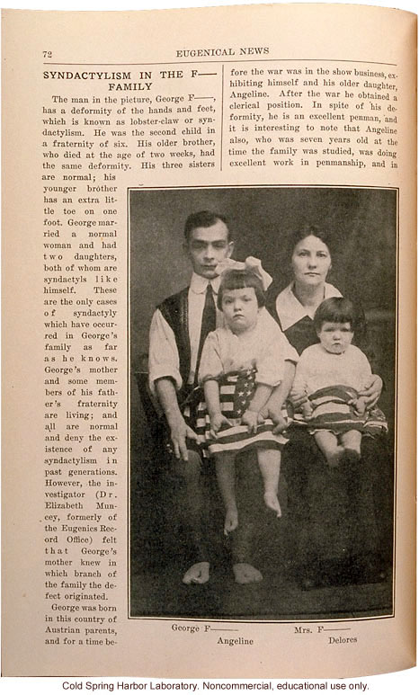 "e;Syndactyly in the F__ Family,"e; Eugenical News (vol. 15), fused fingers or toes -- later shown to be an autosomal dominant trait