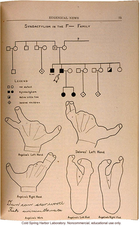 &quote;Syndactyly in the F__ Family,&quote; Eugenical News (vol. 15), fused fingers or toes -- later shown to be an autosomal dominant trait