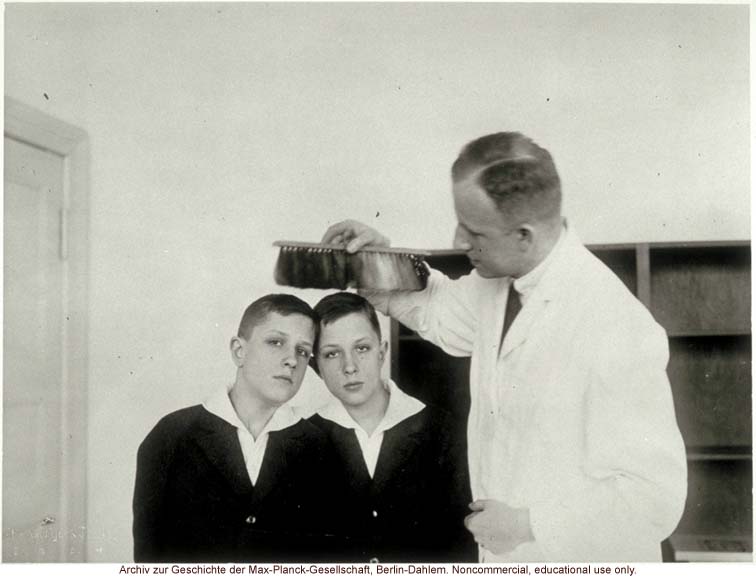 12-year-old male twins undergoing anthropometric study by Otmar Freiherr von Verschuer