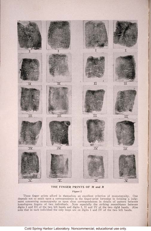 &quote;Mental and Physical Traits of Identical Twins Reared Apart,&quote; by H.H. Newman, <i>Journal of Heredity</i> (vol. 25)