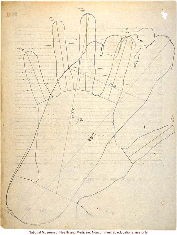 Mico College anthropometric case 2: photos, Schedule 3, measurements, pedigree, notes; by Morris Steggerda for <i>Race Crossing in Jamaica</i>