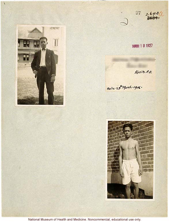 Mico College anthropometric case 3: photos, measurements, pedigree, notes; by Morris Steggerda for <i>Race Crossing in Jamaica</i>