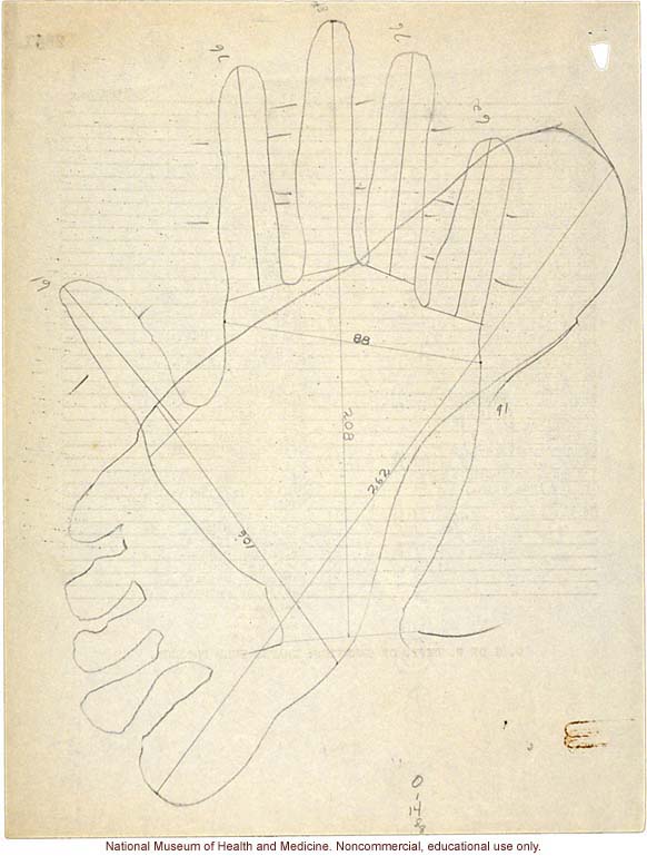 Mico College anthropometric case 3: photos, measurements, pedigree, notes; by Morris Steggerda for <i>Race Crossing in Jamaica</i>