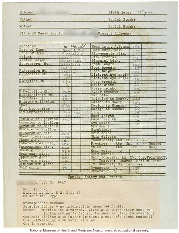 Anthropometry of Dwarves at Letchworth Village for the Feebleminded and Epileptic (measurements, family histories, dental charts, and photographs)