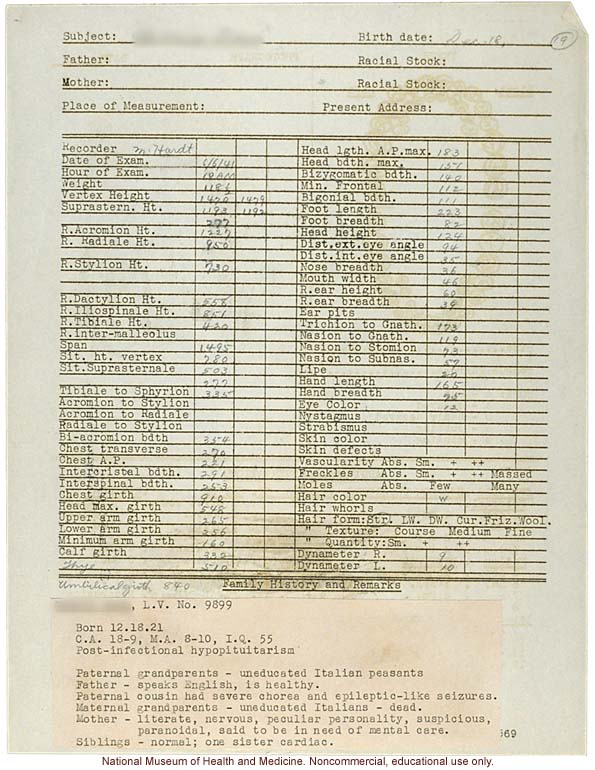 Anthropometry of Dwarves at Letchworth Village for the Feebleminded and Epileptic (measurements, family histories, dental charts, and photographs)