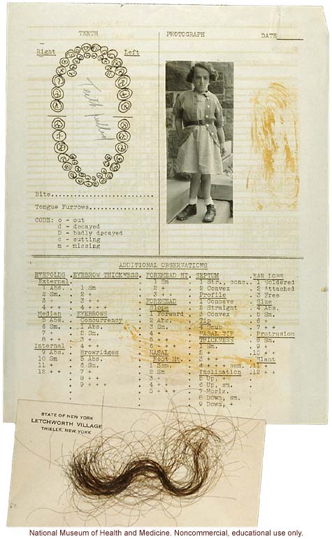 Anthropometry of Dwarves at Letchworth Village for the Feebleminded and Epileptic (measurements, family histories, dental charts, and photographs)
