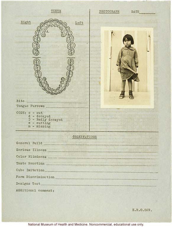 &quote;Growing Series&quote; of Navajo Female age 4-11, Fort Defiance, Arizona (anthropometry, dental charts, and photographs)